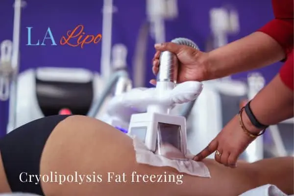 women getting fat freezing Hampton
