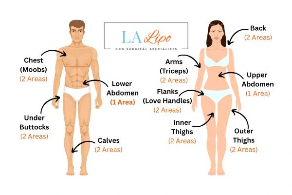 LA LIPO Cryolipolysis Areas Hampton