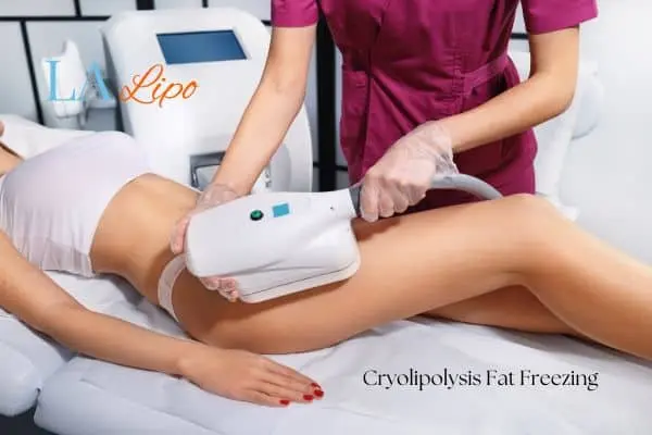 Woman receiving coolsculpting Hampton treatment on her thighs