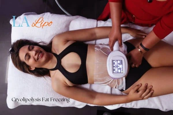 woman getting cryolipolysis Hampton