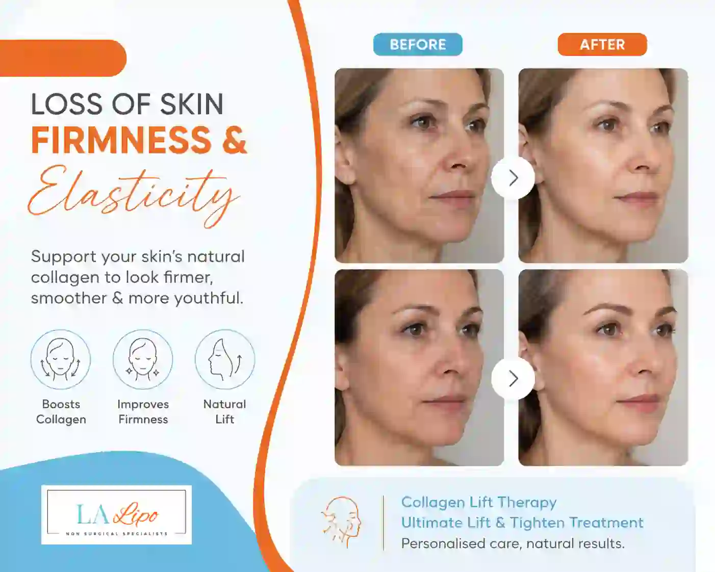 Sign #7: Loss of Skin Firmness and Elasticity Hampton